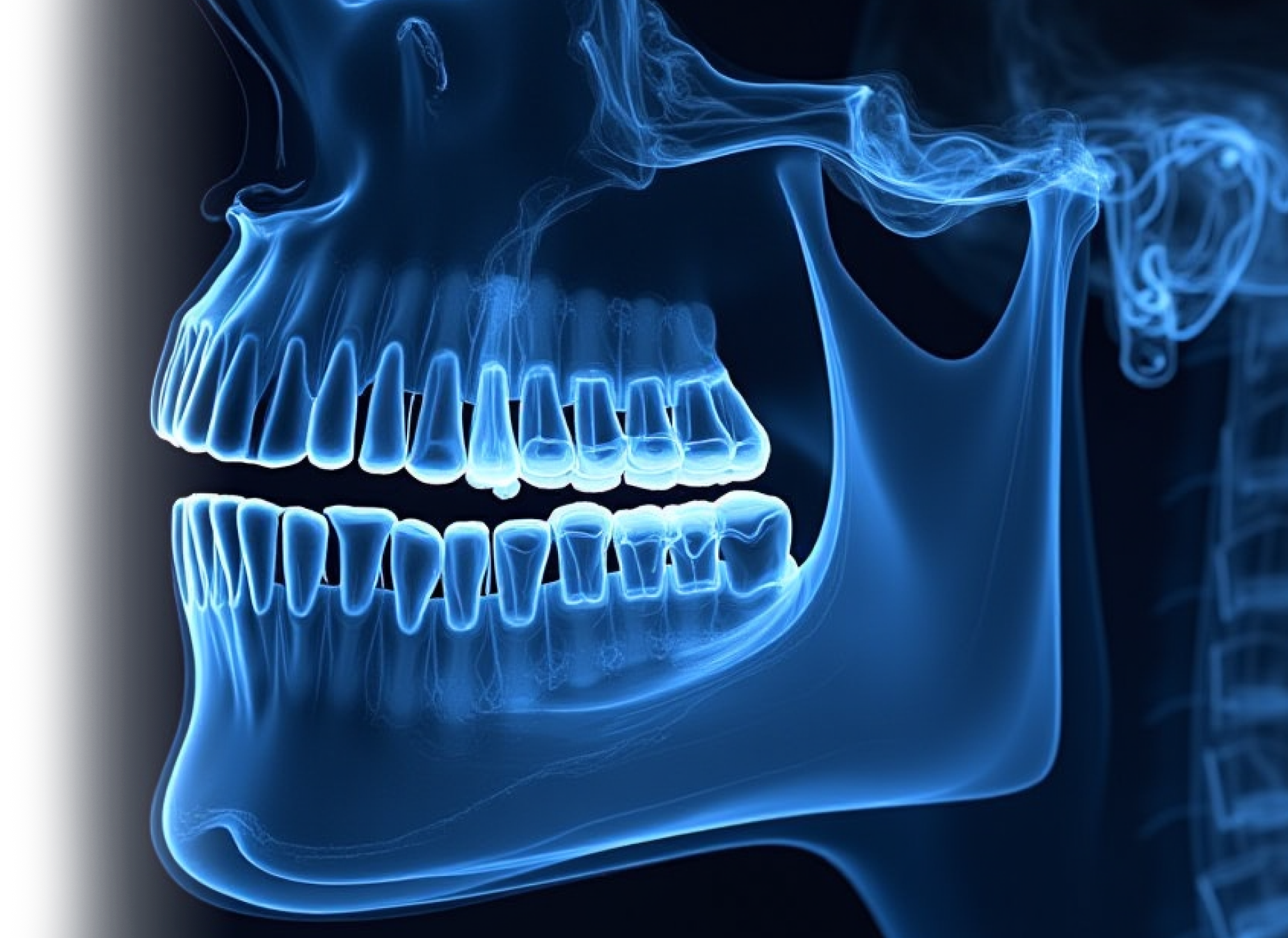 МСКТ челюсти