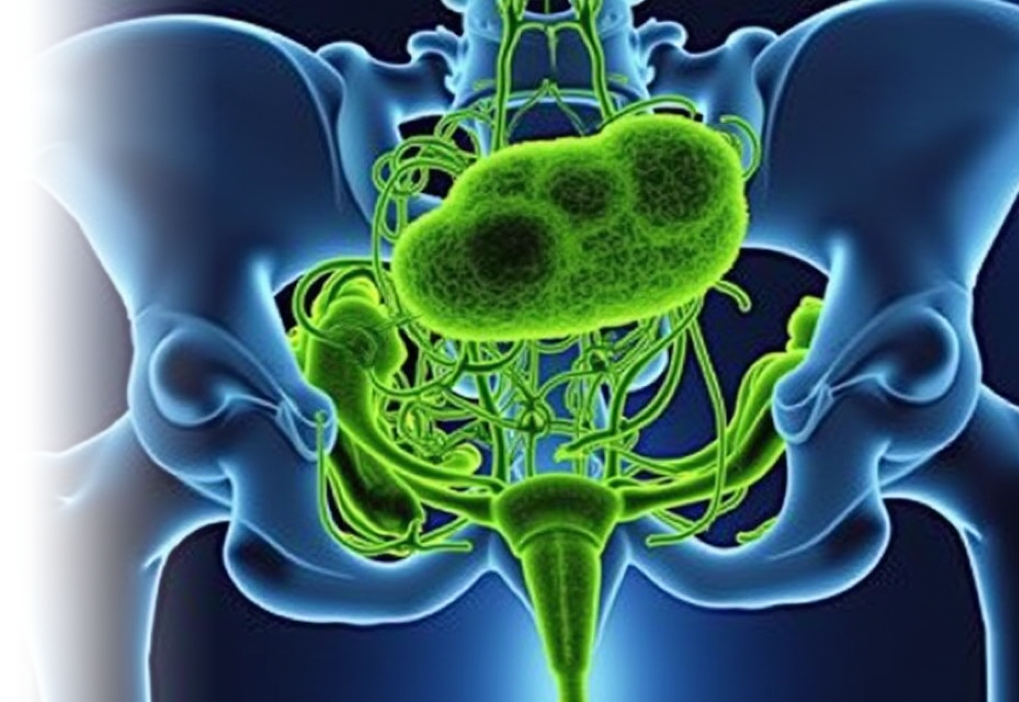 КТ мочевыделительной системы с контрастированием