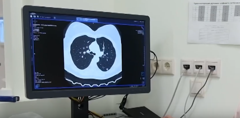 КТ диагностика. Комплексный подход к сезонным заболеваниям