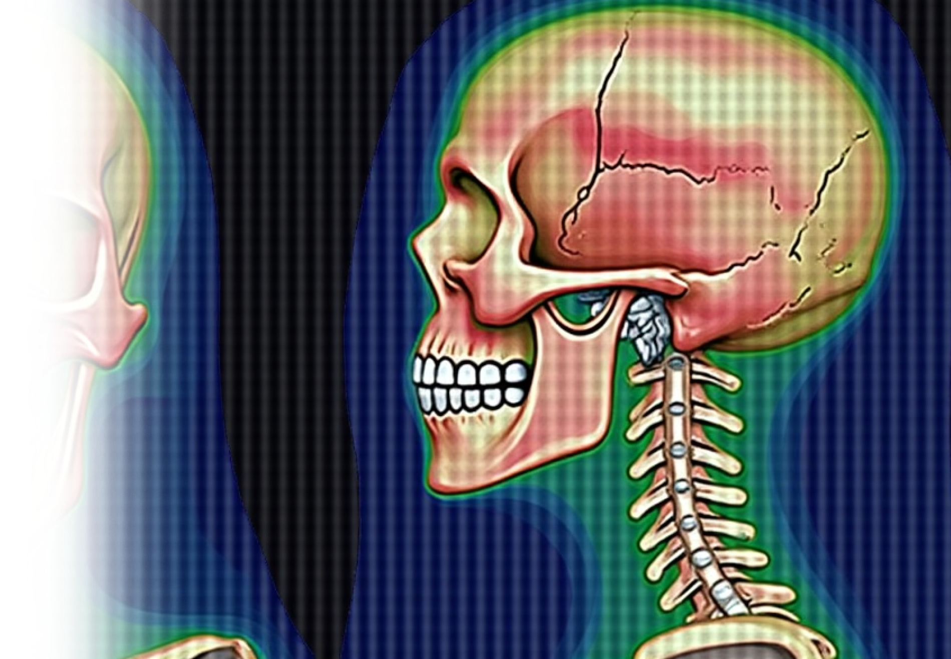 КТ височных костей