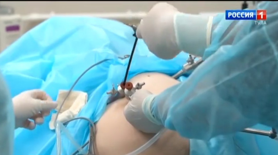 Лапароскопические операции в клинике "Семейная"