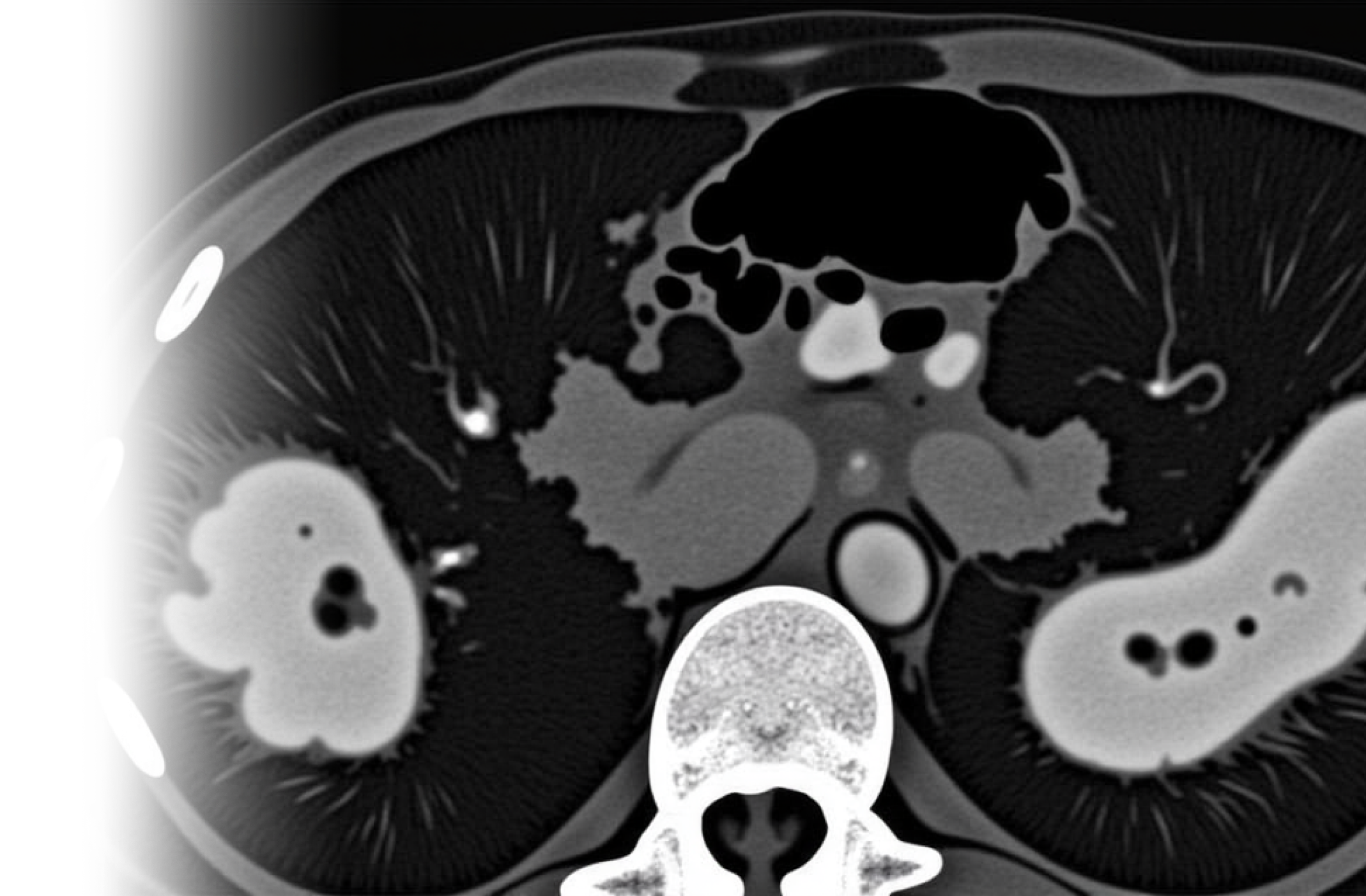 КТ органов грудной клетки, брюшной полости и забрюшинного пространства