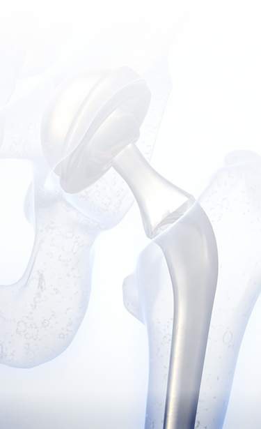 Эндопротезирование суставов