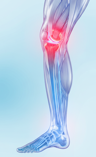 Артроскопия коленного сустава