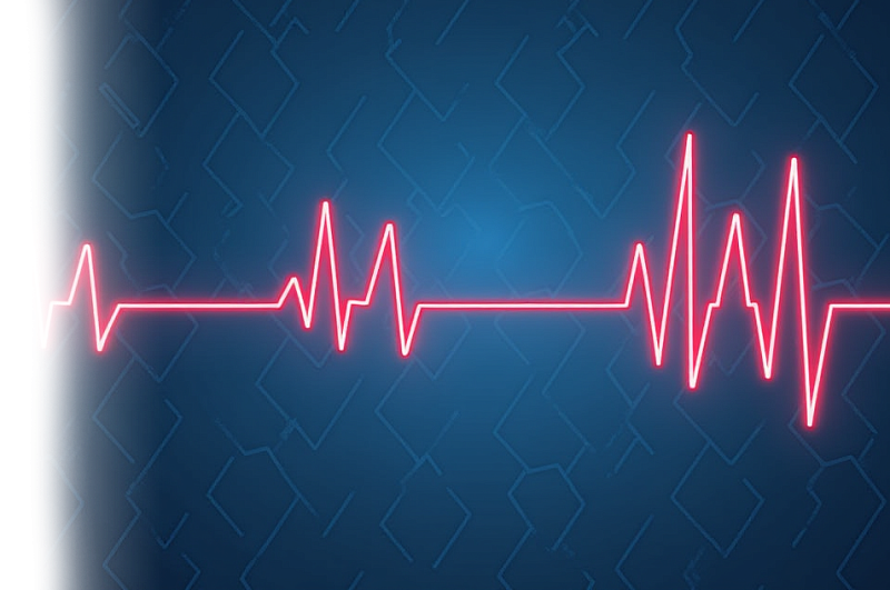 Холтеровское мониторирование ЭКГ