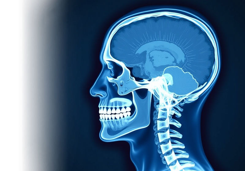 КТ головного мозга с контрастированием